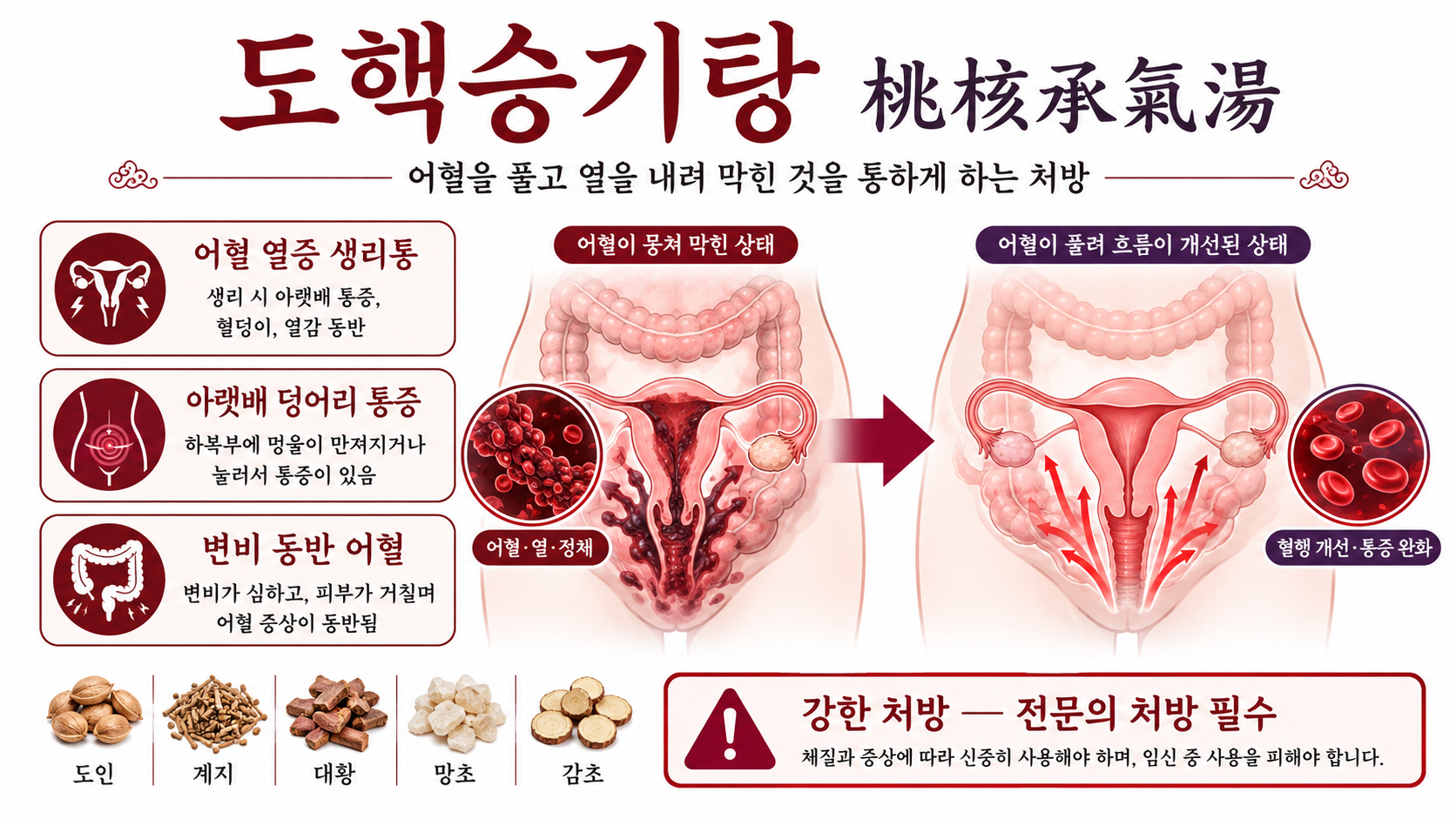도핵승기탕 인포그래픽