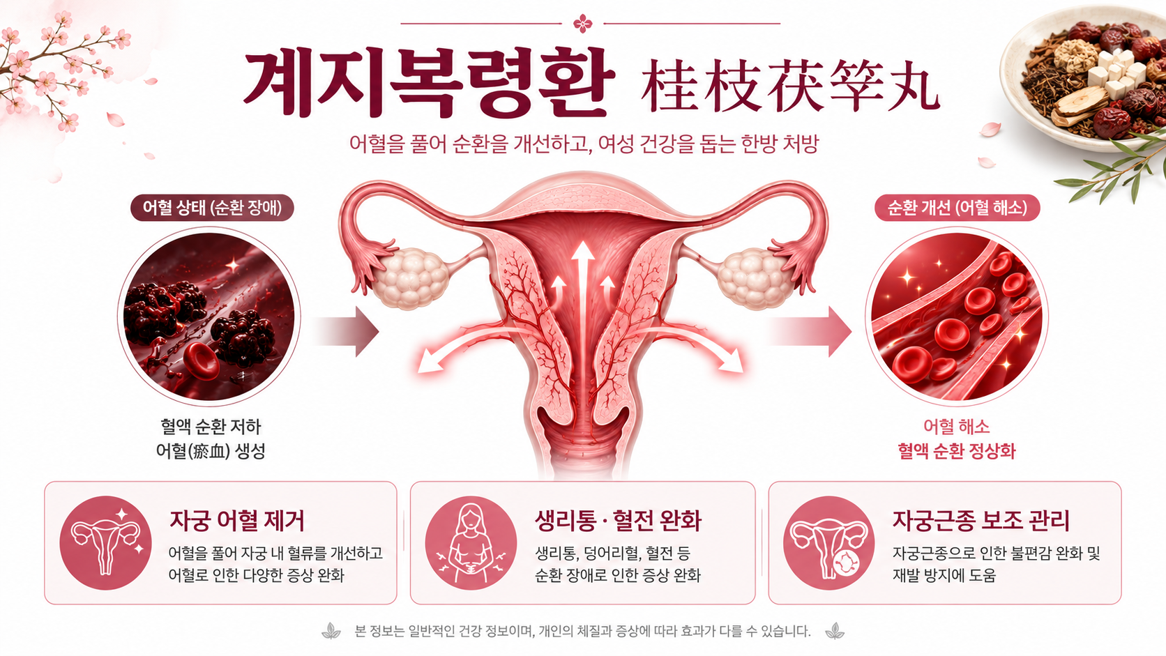 계지복령환 인포그래픽