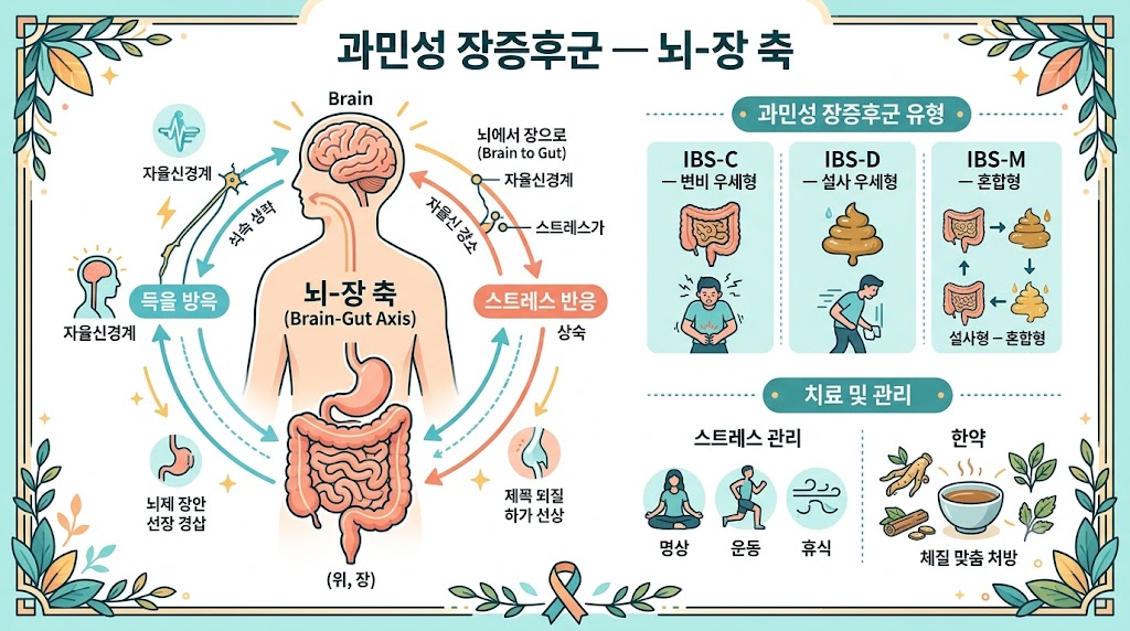 IBS 과민성 대장 인포그래픽