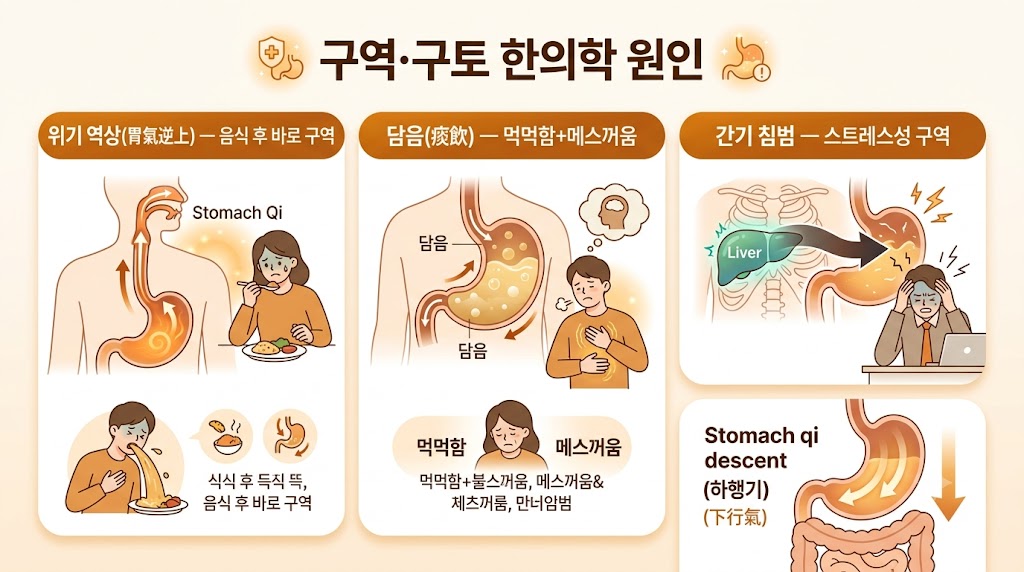 구역 구토 인포그래픽