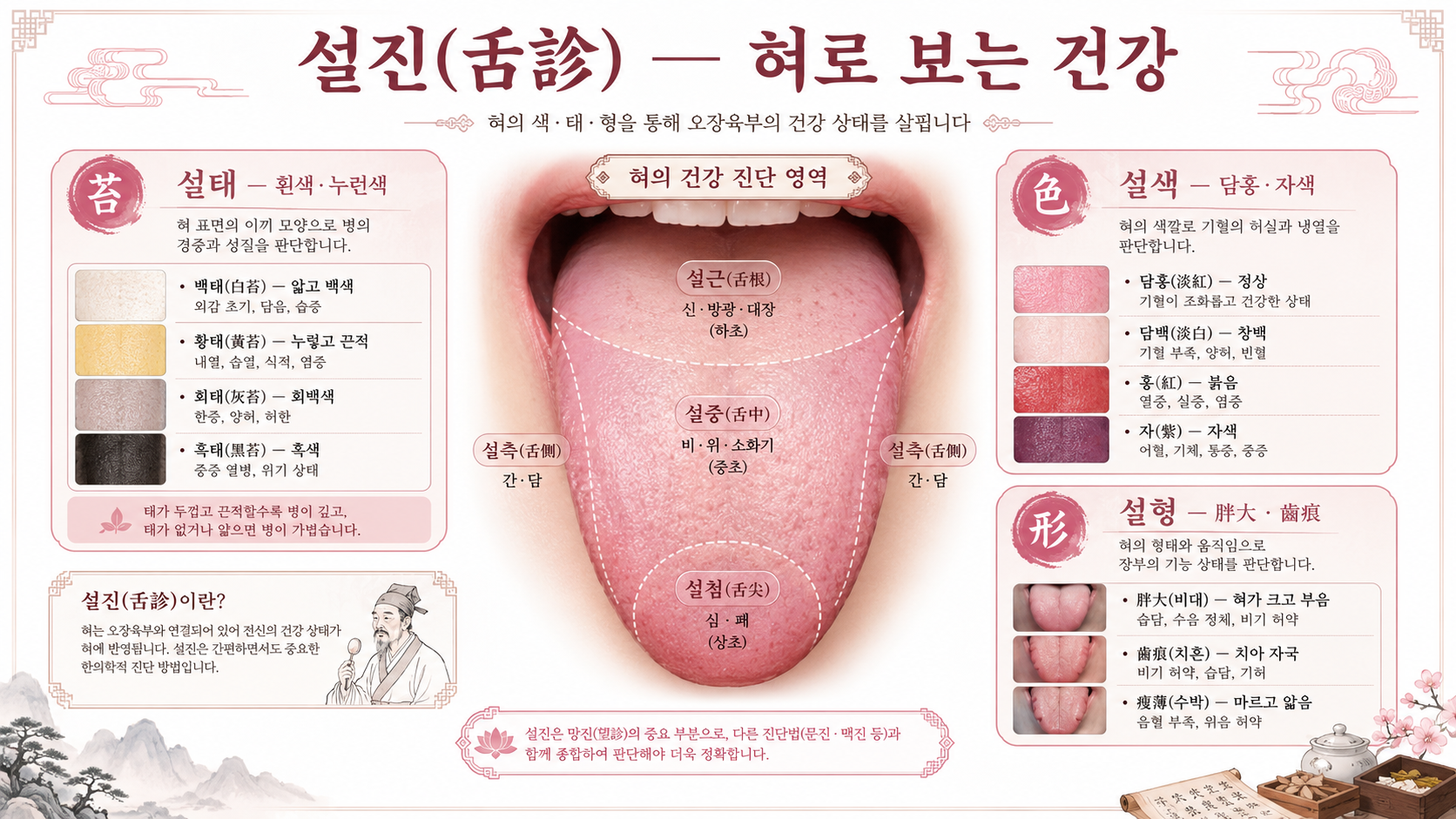 설진 인포그래픽