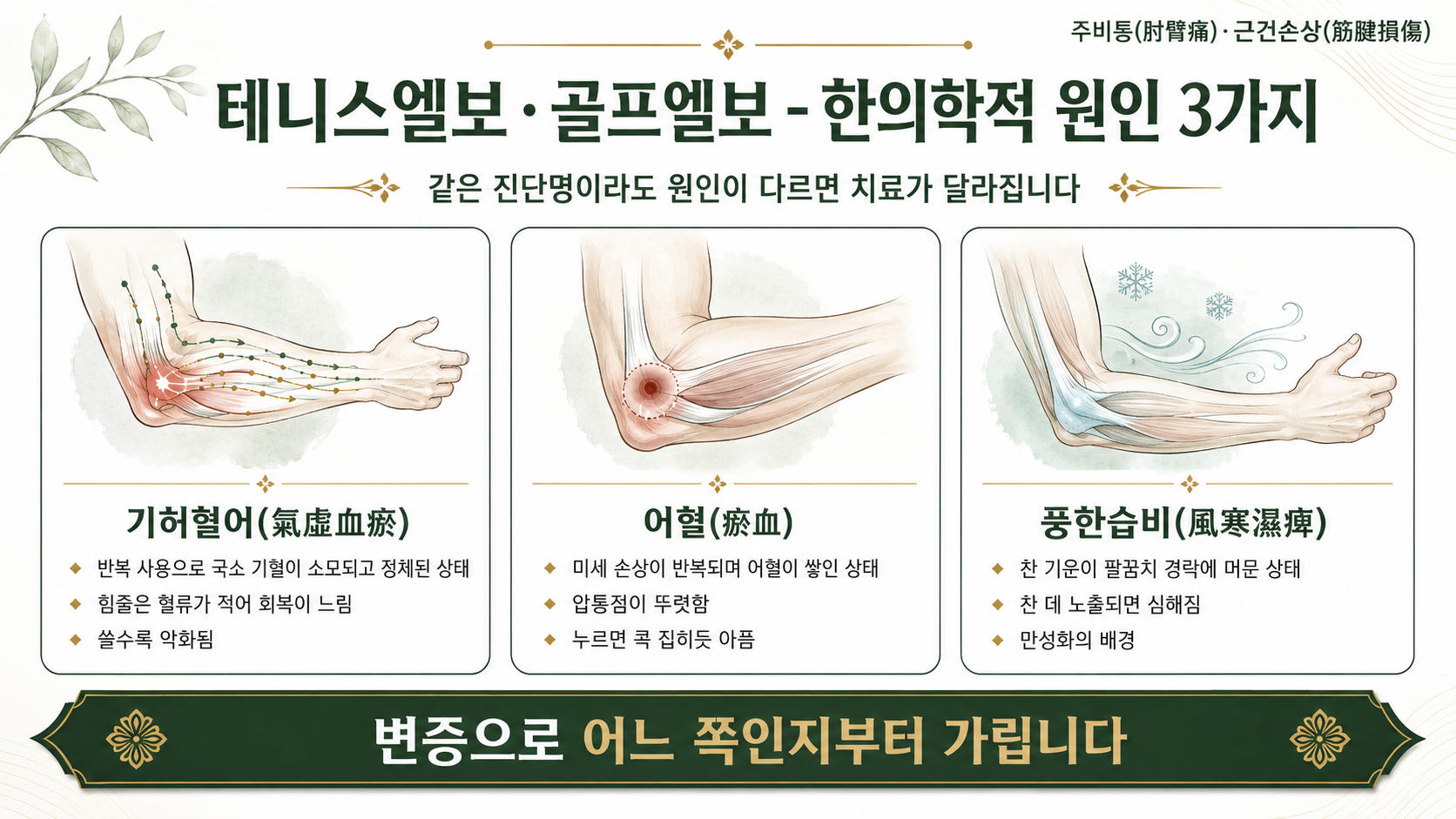 인천송도 더율한의원 테니스엘보·골프엘보 한의학적 원인 인포그래픽