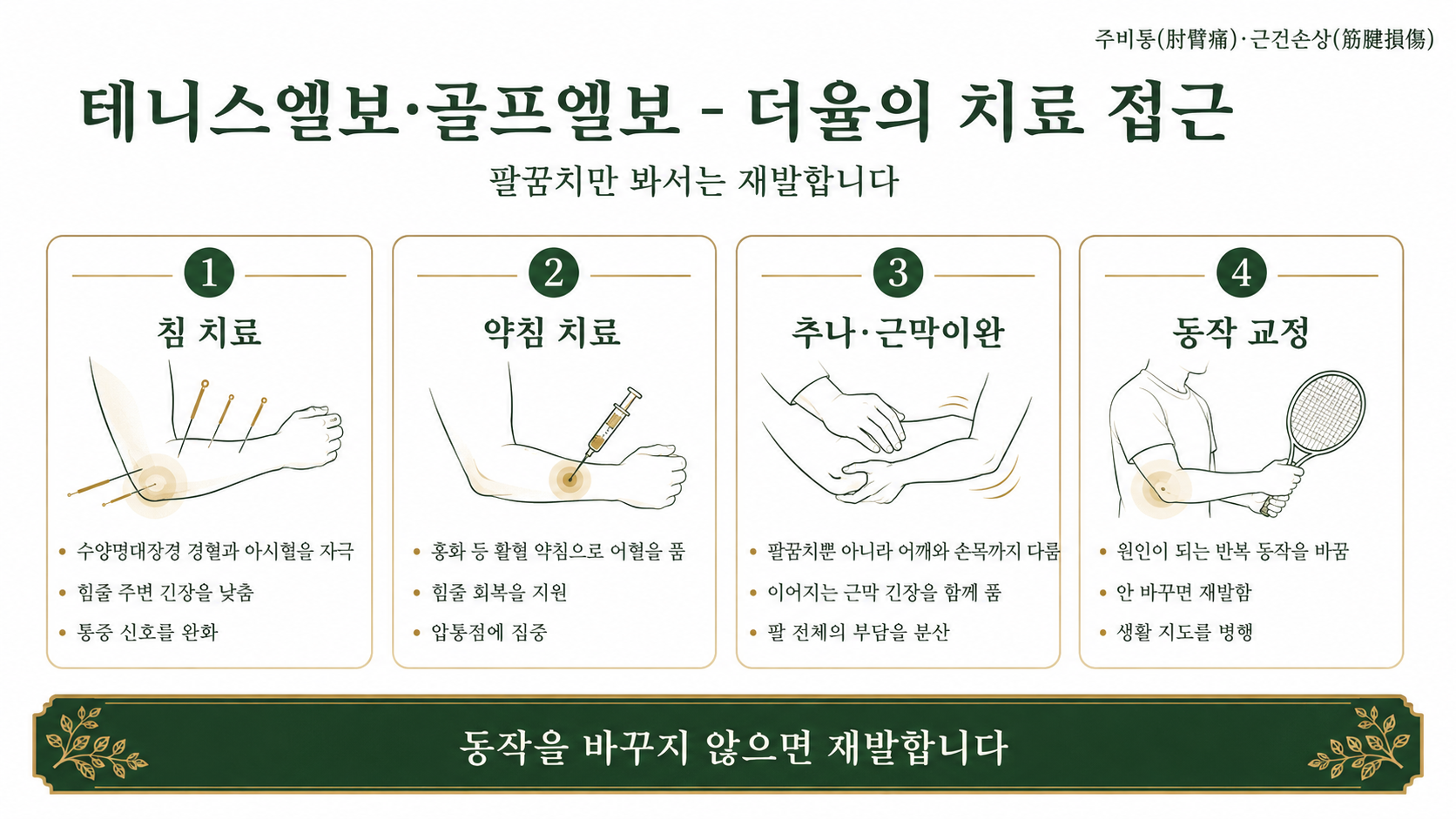 인천송도 더율한의원 테니스엘보·골프엘보 치료 방법 인포그래픽