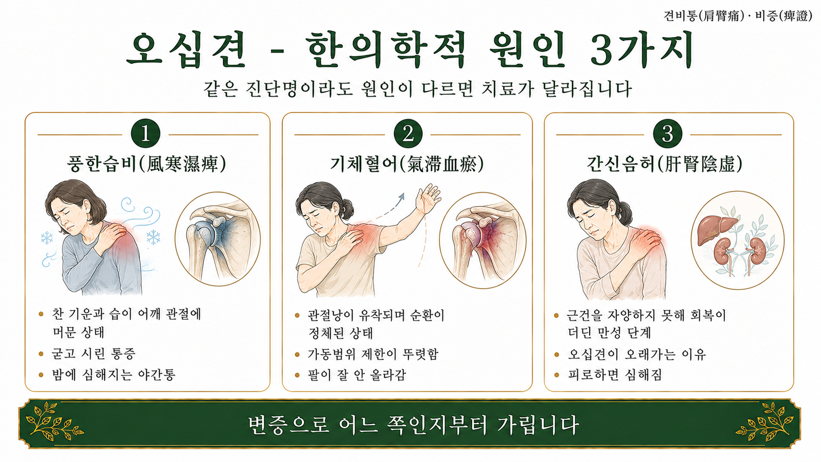 인천송도 더율한의원 오십견 한의학적 원인 인포그래픽
