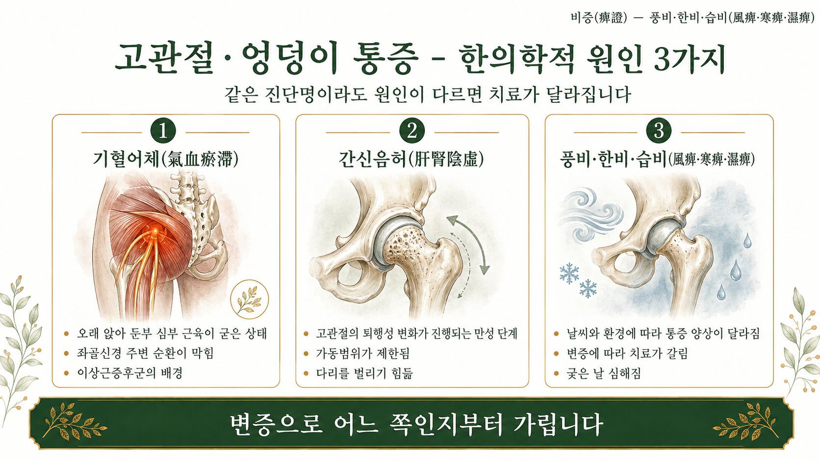 인천송도 더율한의원 고관절 통증 한의학적 원인 인포그래픽