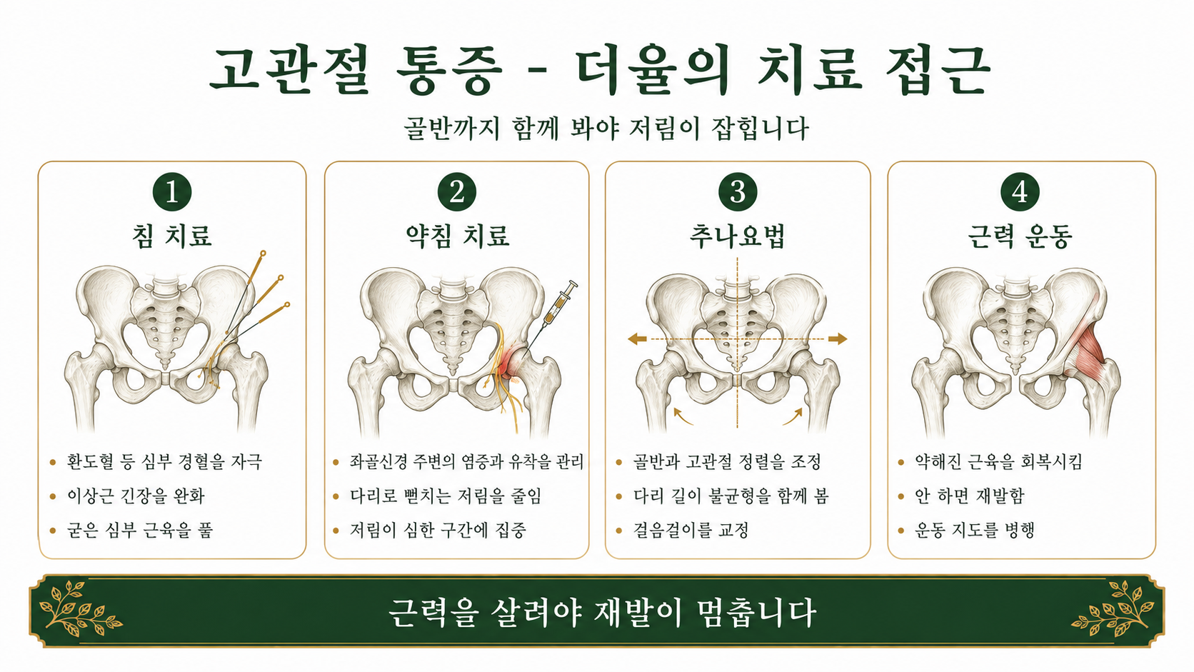 인천송도 더율한의원 고관절 통증 치료 방법 인포그래픽