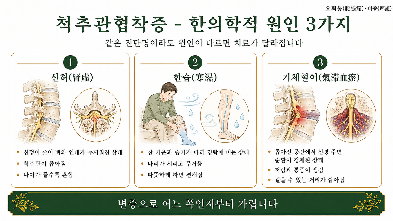 인천송도 더율한의원 척추관협착증 한의학적 원인 인포그래픽