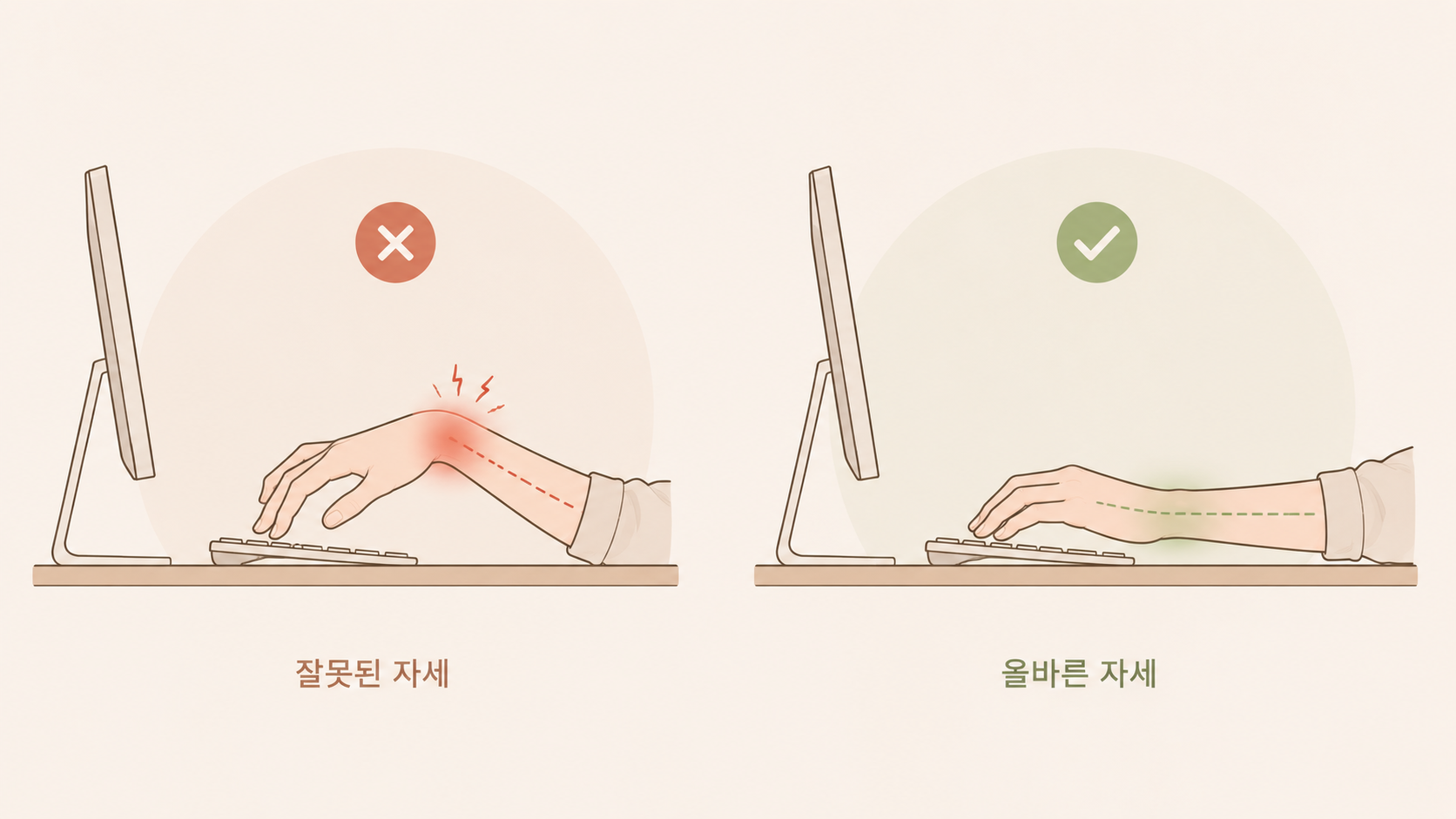 올바른 손목 자세 vs 잘못된 자세