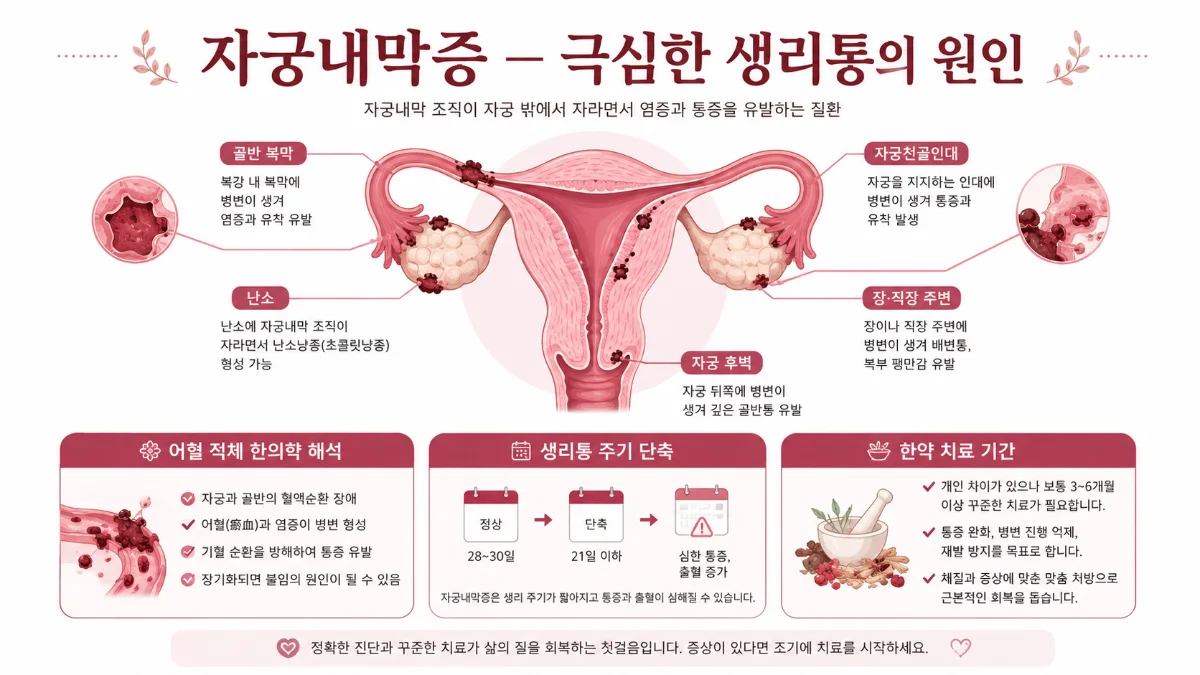 여름철 냉방병과 습열 관리 — 에어컨이 망치는 몸