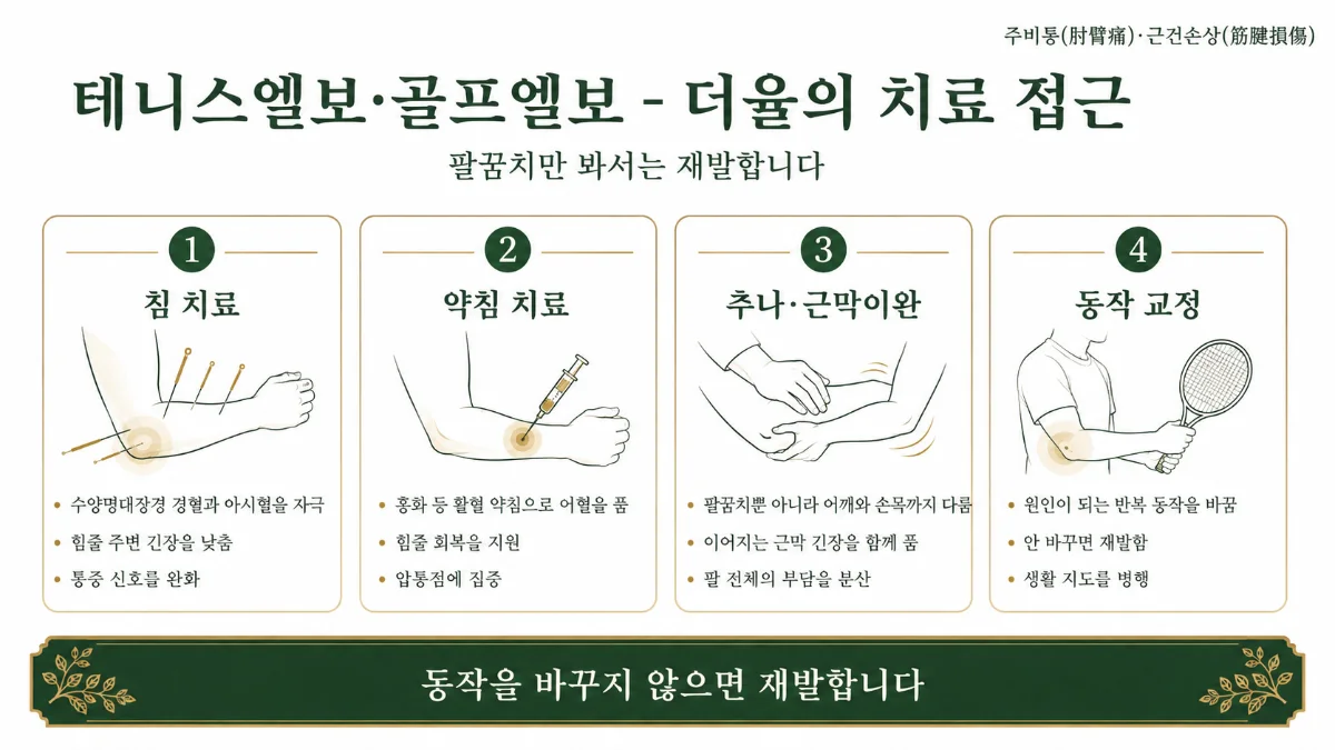 인천송도 더율한의원 테니스엘보·골프엘보 치료 방법 인포그래픽