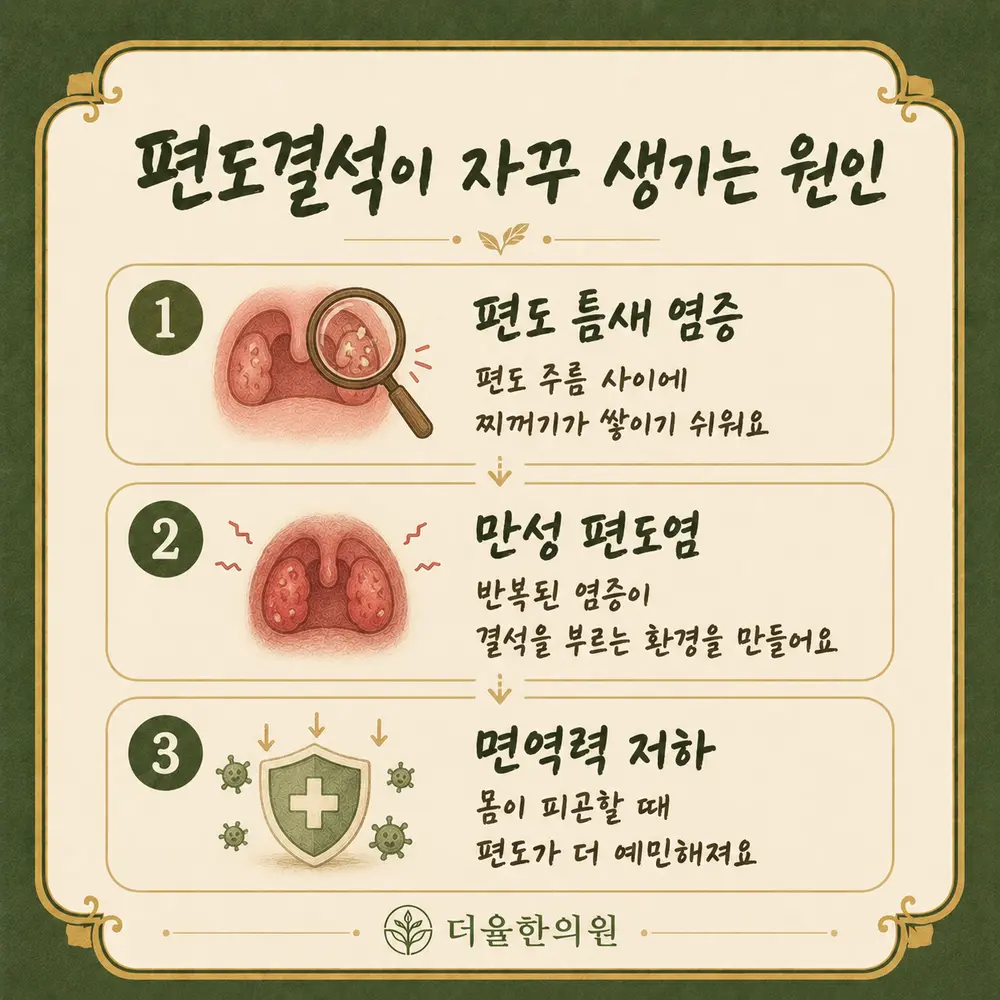 편도결석 한방치료 - 인천 송도 더율한의원