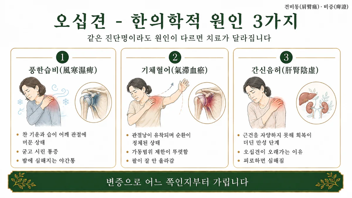 인천송도 더율한의원 오십견 한의학적 원인 인포그래픽