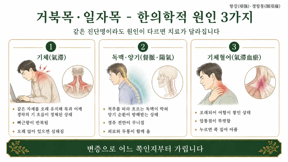 인천송도 더율한의원 거북목·일자목 한의학적 원인 인포그래픽