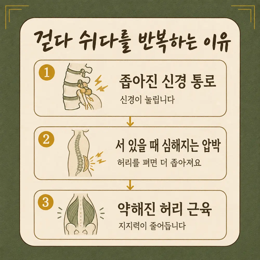 척추관협착증 보행 한방치료 - 인천 송도 더율한의원
