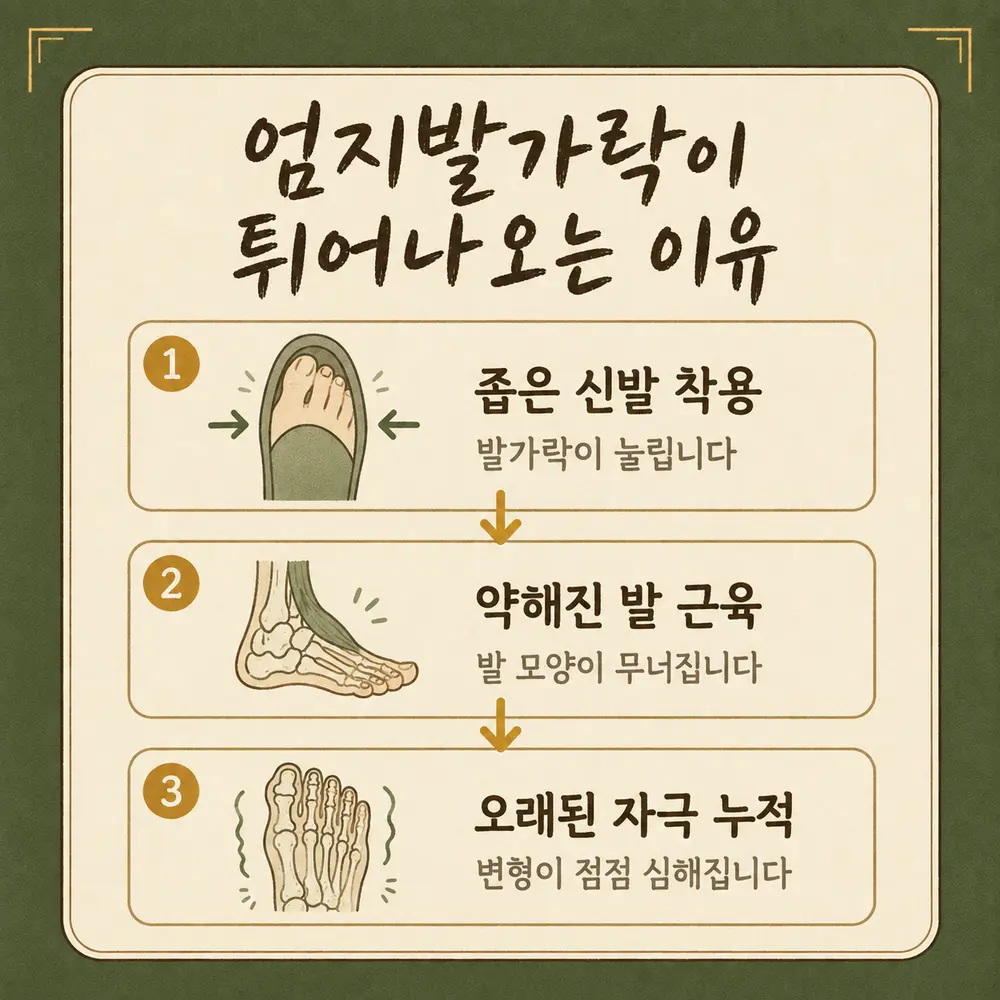 무지외반증 상담 - 인천 송도 더율한의원