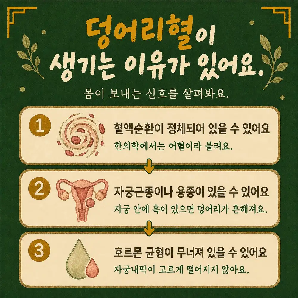 생리 덩어리 상담 - 인천 송도 더율한의원