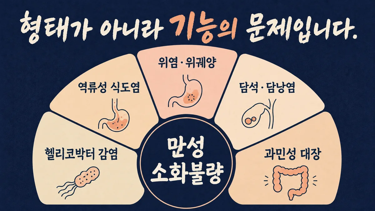 인천 송도 더율한의원 - 기능성 소화불량 원인
