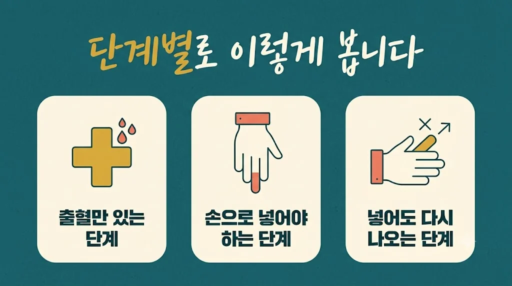 인천 송도 더율한의원 - 치질 증상