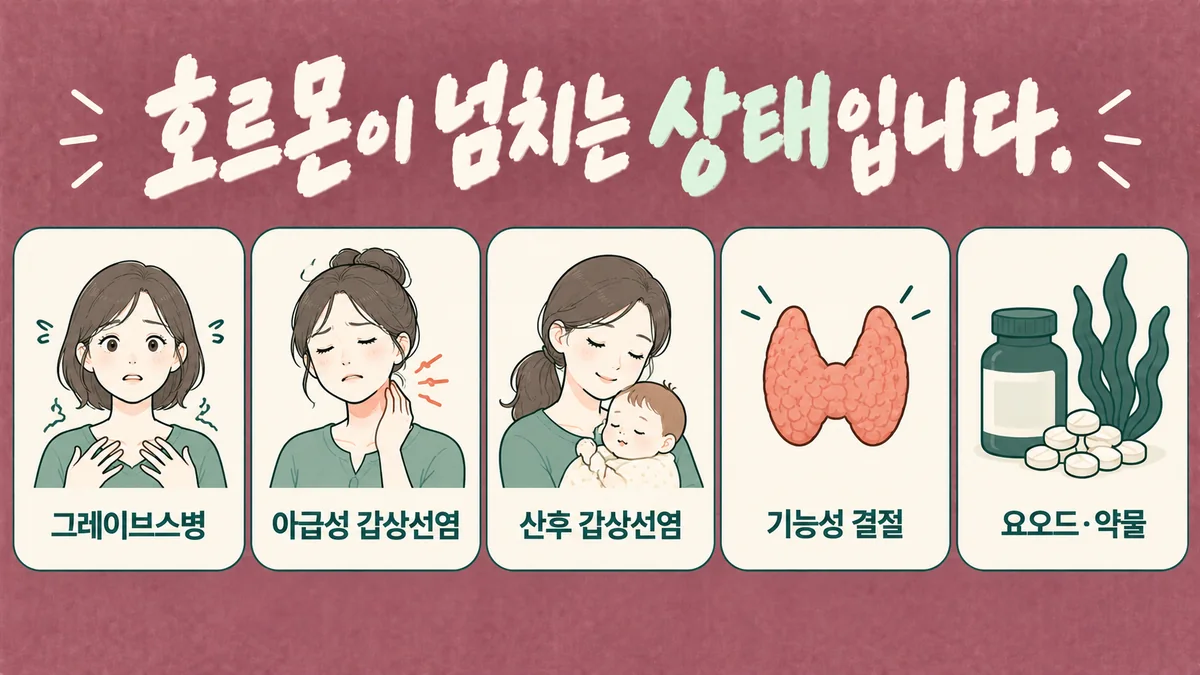 인천 송도 더율한의원 - 갑상선기능항진증 원인