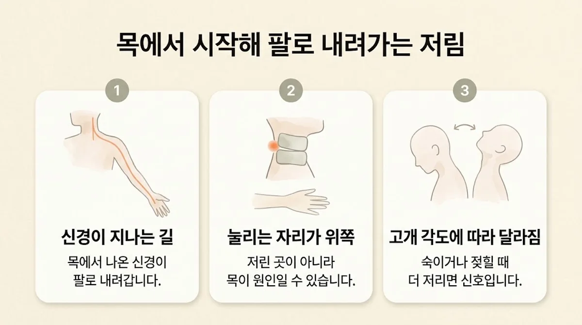 미추홀구한의원 목디스크 원인 - 신경이 지나는 길·눌리는 자리는 위쪽·고개 각도에 따라
