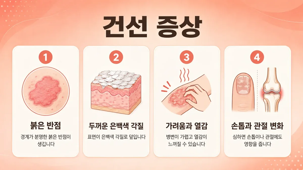 인천 송도 더율한의원 - 건선 증상